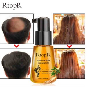 RtopR Prevent Hair Loss Oil